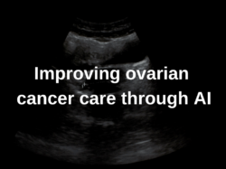 Improving ovarian cancer care through AI